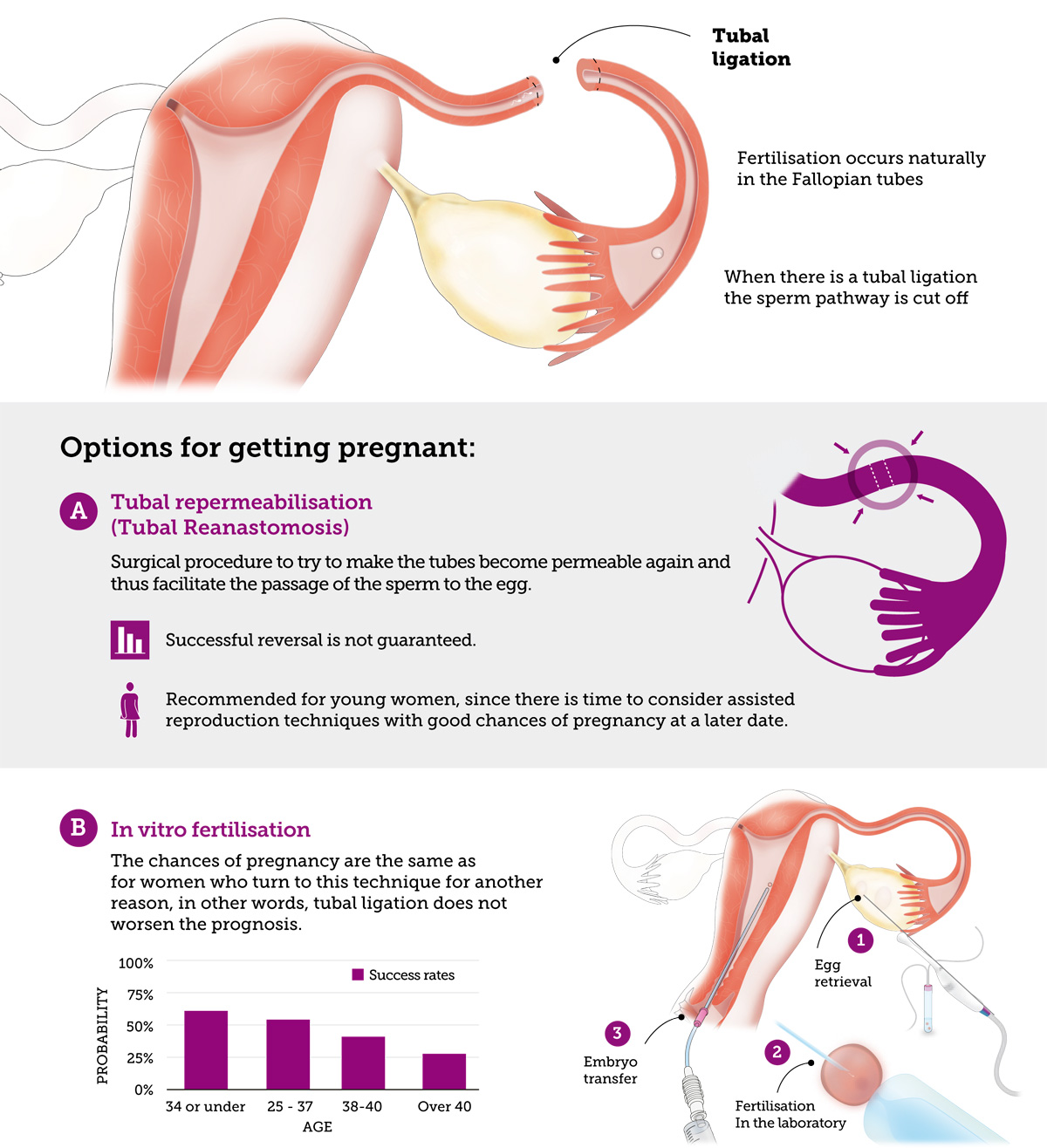 infografika dotycząca szans zajścia w ciążę po podwiązaniu jajowodów