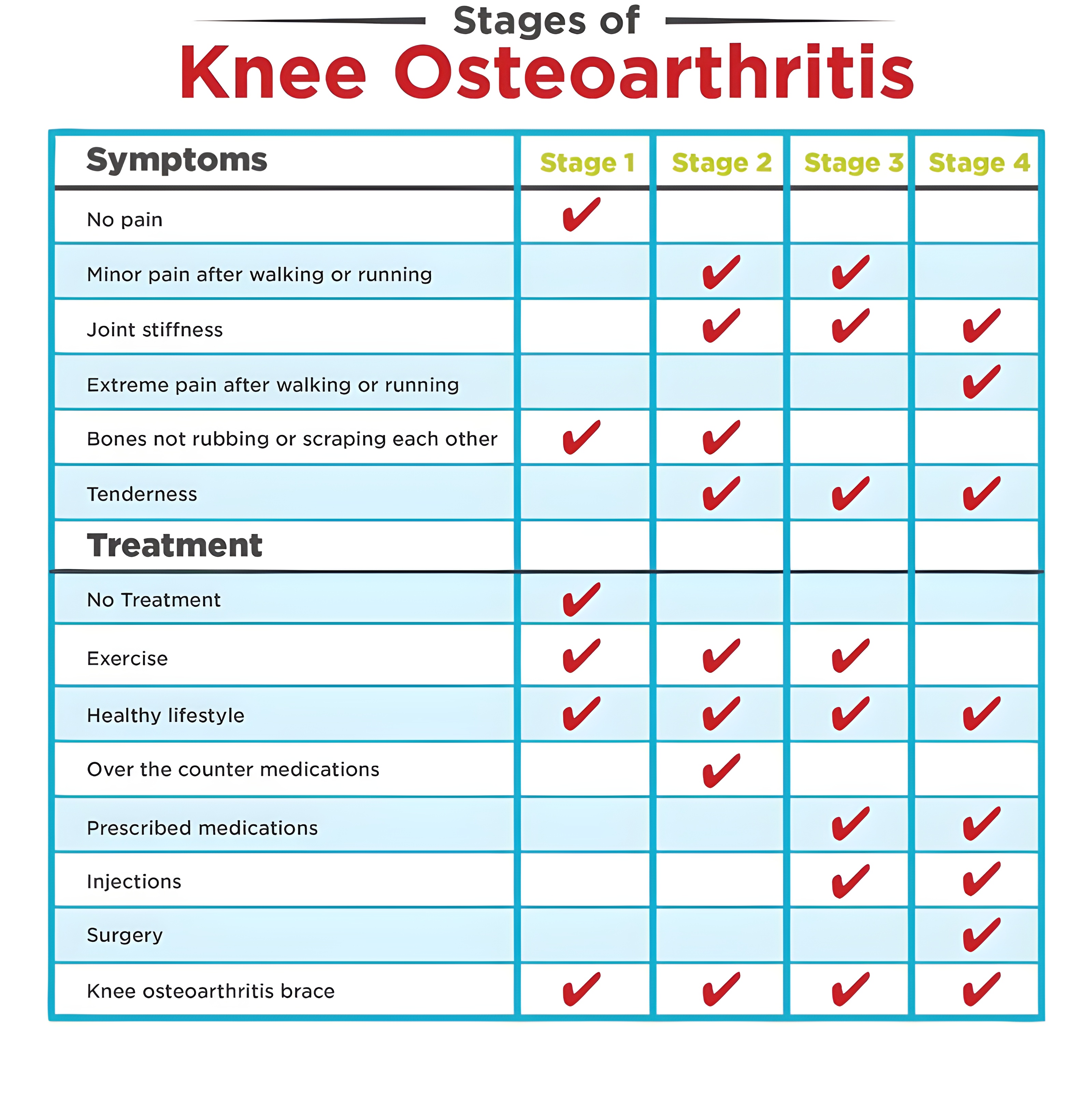Table of symptoms of osteoarthritis at different stages