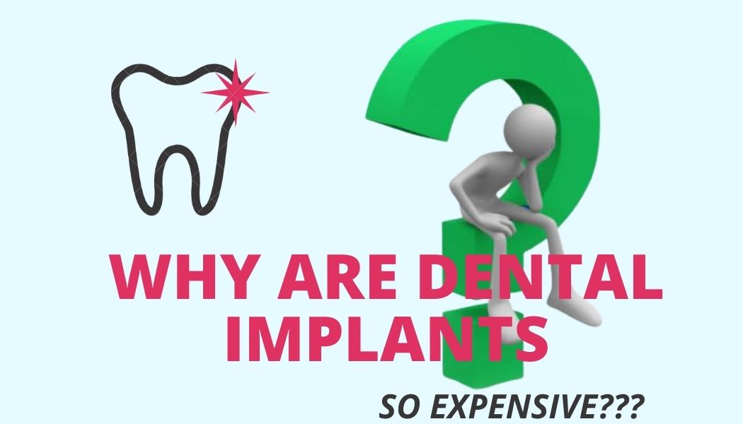 Infografika - myślący człowiek, dlaczego implanty są takie drogie, wzór zęba